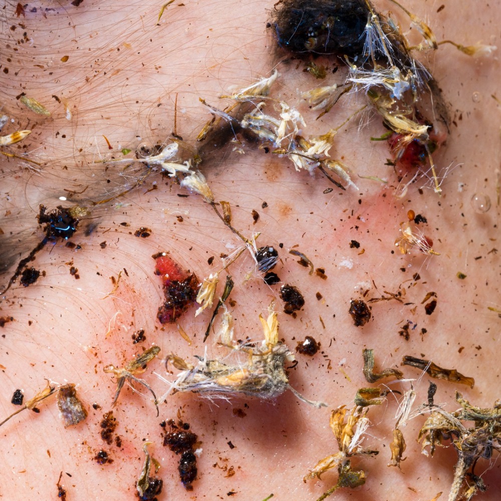 Dans mon appartement durant le confinement, c'est mon compost qui était devenu mon évasion dans la nature. Soumise à un nouveau regard sur les matières organiques, j'explorais ce micro écosystème qui m’entourait, ainsi que son processus de dégradation. Des fruits, des fourmis ou encore de la peau s’associent pour former un nouvel imaginaire, où les matières vivantes se rencontrent et fusionnent.